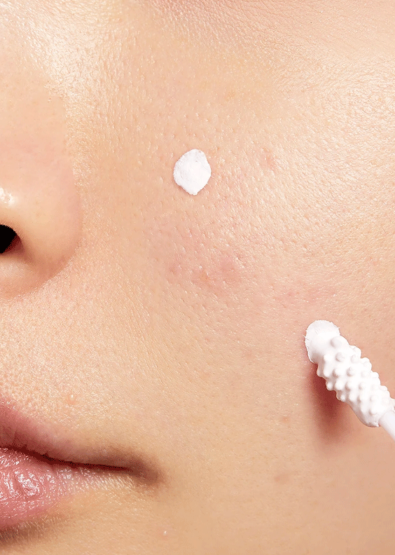 COSRX-Blemish-Spot-Drying-Lotion-on-skin skincare-kbeauty-glowtime-COSRX Blemish Spot Drying Lotion