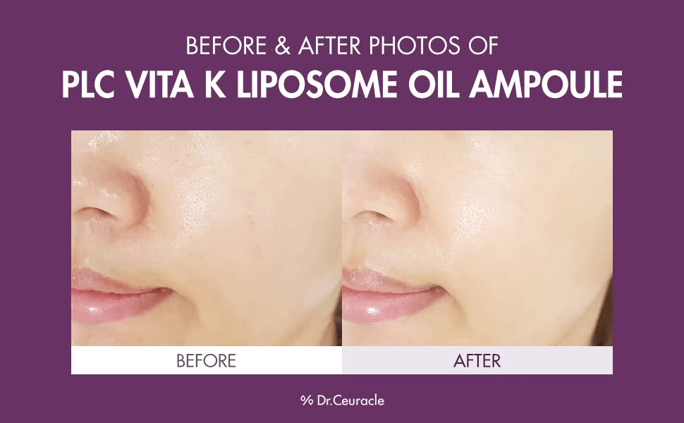 DR CEURACLE Vita K Liposomes Oil Ampoule 3 skincare-kbeauty-glowtime-dr ceuracle vita k liposomes oil ampoule