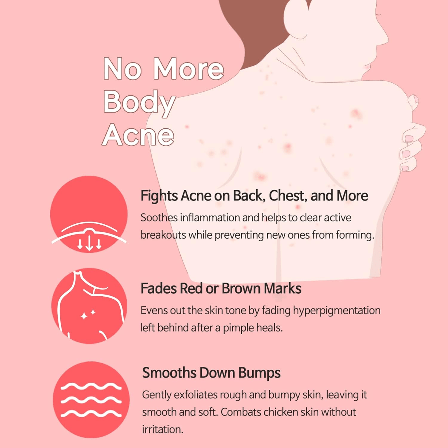 TIAM Anti Blemish Body Lotion 2 skincare-kbeauty-glowtime-tiam anti blemish body lotion