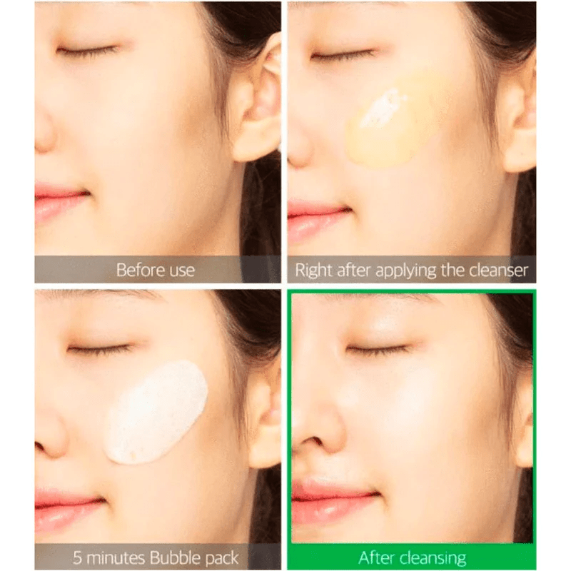 Some-By-Mi-Bye-Bye-Blemish-Vita-Tox-Brightening-Bubble-Cleanser before and after skincare-kbeauty-glowtime-some b y mi bye bye blemish vita tox brightening bubble cleanser