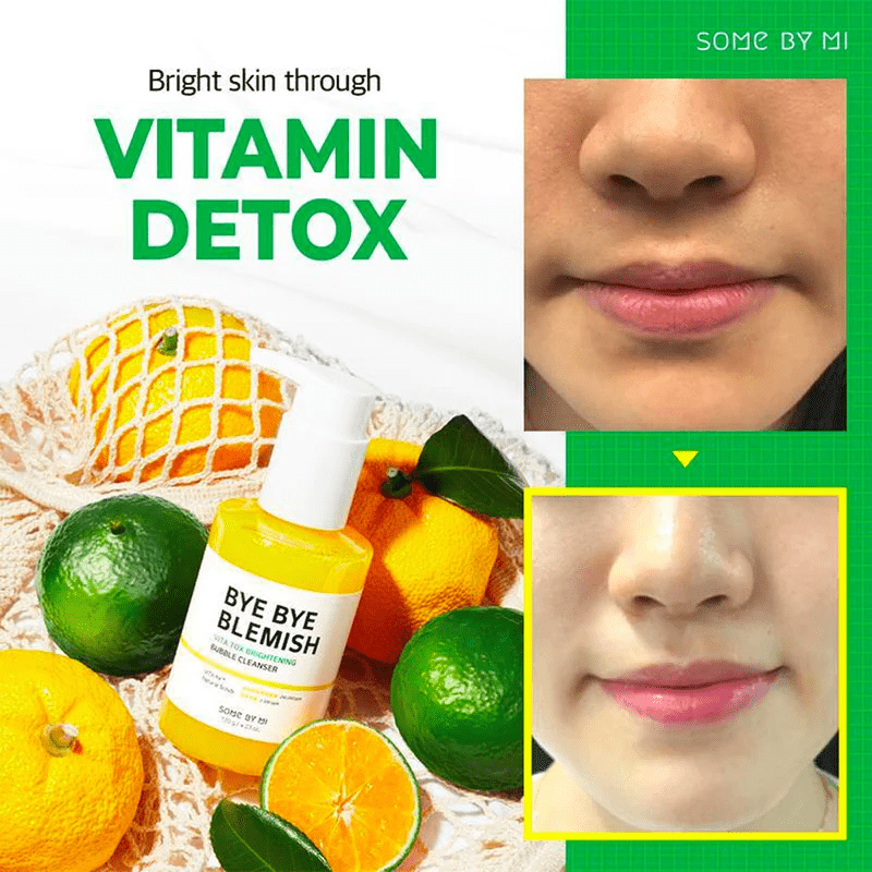 Some-By-Mi-Bye-Bye-Blemish-Vita-Tox-Brightening-Bubble-Cleanser fruit skincare-kbeauty-glowtime-some b y mi bye bye blemish vita tox brightening bubble cleanser