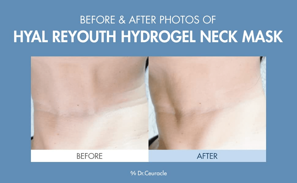 dr ceuracle hyal reyouth hydrogel neck mask before and after skincare-kbeauty-glowtime-dr ceuracle hyal reyouth hydrogel neck mask