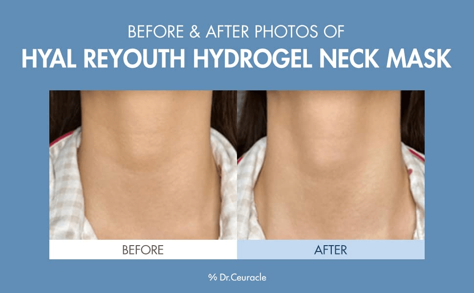 dr ceuracle hyal reyouth hydrogel neck mask model skincare-kbeauty-glowtime-dr ceuracle hyal reyouth hydrogel neck mask