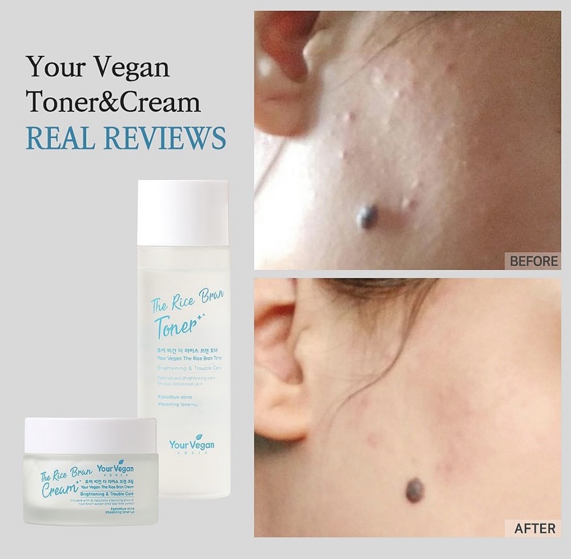 IMG_6625 skincare-kbeauty-glowtime-your vegan the rice bran toner