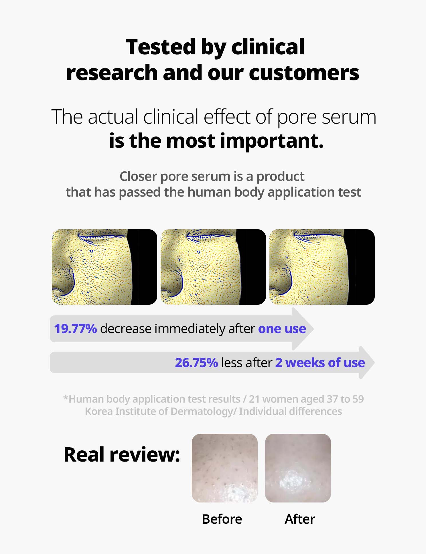 클로저 세럼_ 제품별 상세페이지(썸네일)_1488x1936_3 skincare-kbeauty-glowtime-frankly closer serun