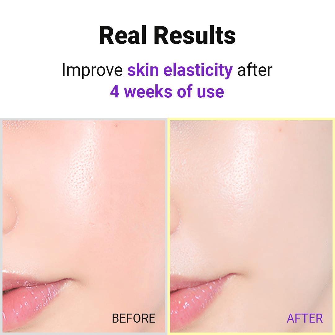 ISNTREE Hper REtinol EX 1.0 Serum 5 skincare-kbeauty-glowtime-isntree hyper retinol Express Delivery ( 1-2 working days) RS175 1.0 serum