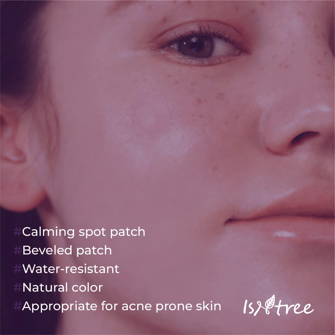 ISNTREE Onion Newpair Spot Patch Basic 5 skincare-kbeauty-glowtime-isntree onion newpair spot patch basic