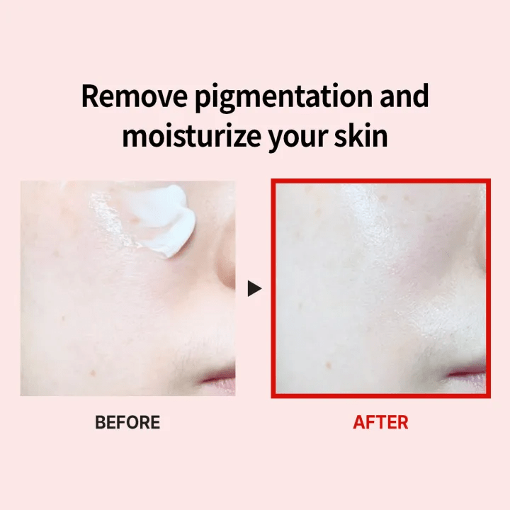 Medi Peel Melanon X Drop Gel cream 4 skincare-kbeauty-glowtime-medi peel melanon x drop gel cream
