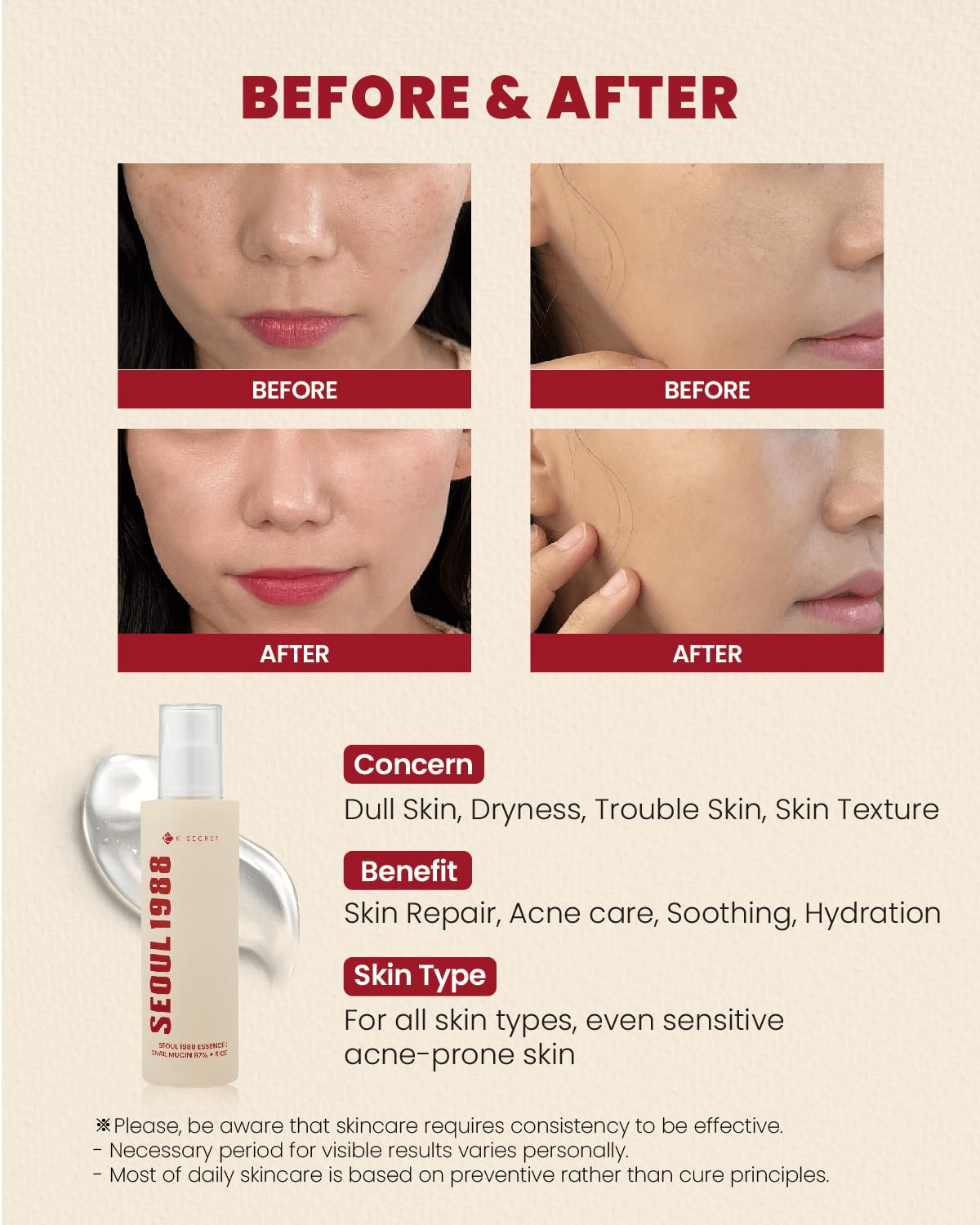 K SECRET Seoul 1988 Essence Snail Mucins 97% Rice 3 skincare-kbeauty-glowtime-k secret seoul 1988 essence snail mucin 97% + Rice