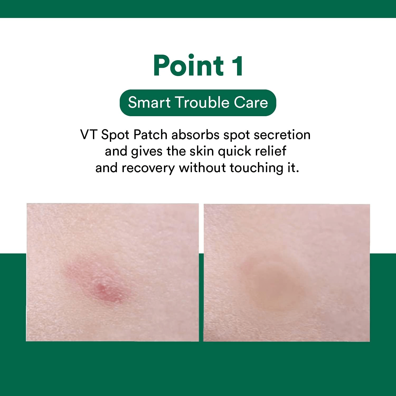VT COSMETICS Cica Care Spot Patch 3 skincare-kbeauty-glowtime-VT COSMETICS Cica care Spot Patch