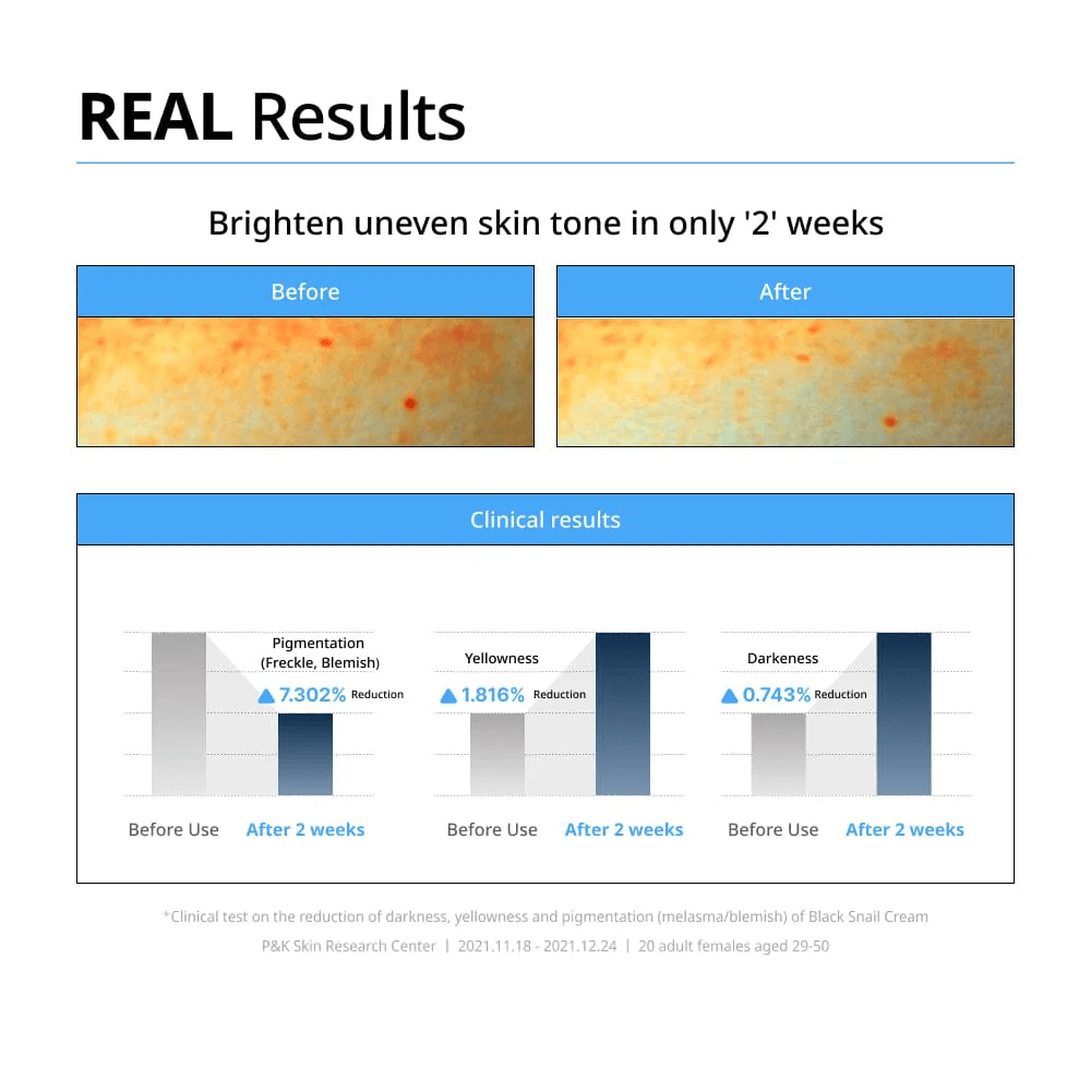 Dr G Black Snail Cream 4 skincare-kbeauty-glowtime-dr g black snail cream