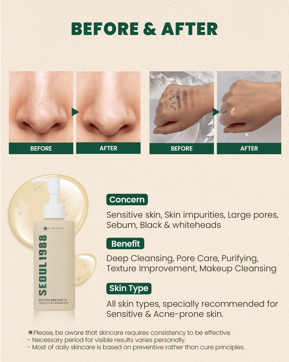 K SECRET Seoul 1988 Cleansing Oil pine Cica probiotics 3 skincare-kbeauty-glowtime-k secret soul 1988 cleansing oil pine cica probiotics