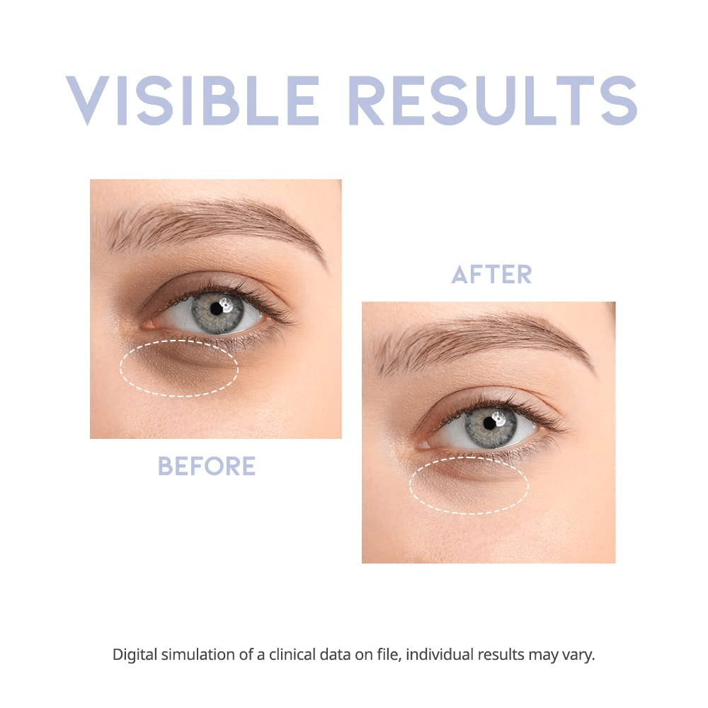 OOTD Intensive Eye Serum 5 skincare-kbeauty-glowtime-OOTD Intensive Eye Serum