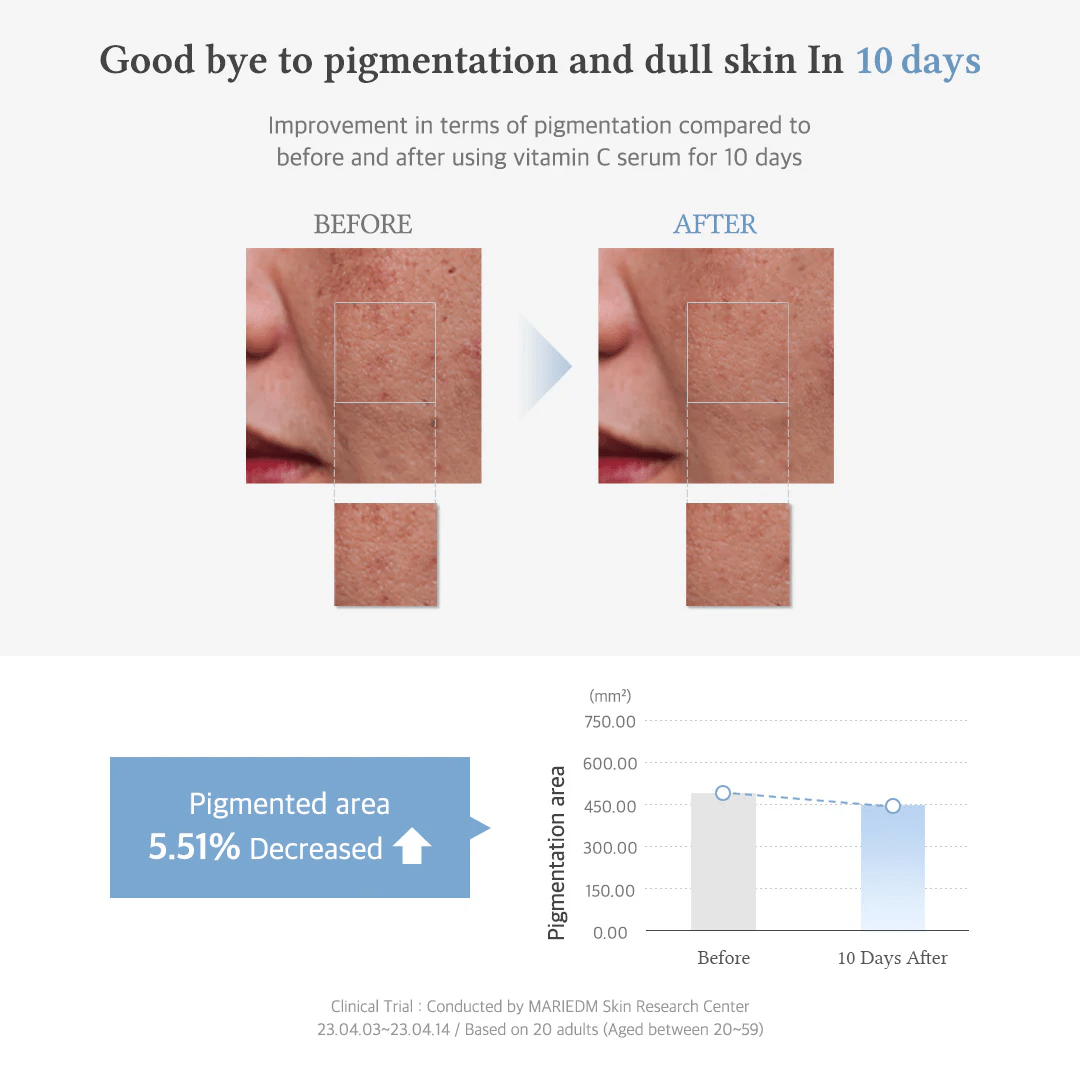 Vitamin C Boosting Serum 6 skincare-kbeauty-glowtime-DR Althea Vitamin C Boosting Serum