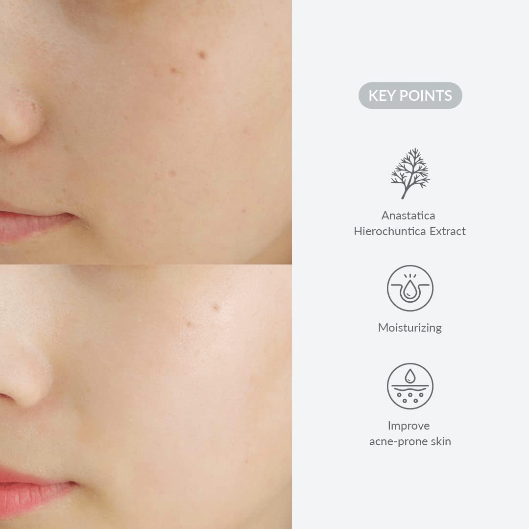 DR ALTHEA Last Minute Skin Rescue Anastatica Mask 2 skincare-kbeauty-glowtime-dr althea last minute skin rescue anastatica mask