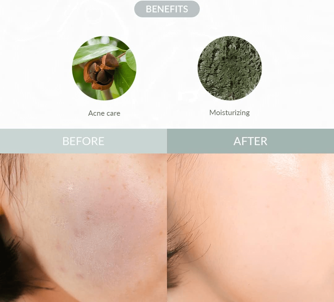 DR ALTHEA Last Minute Skin Rescue Anastatica Mask 4 skincare-kbeauty-glowtime-dr althea last minute skin rescue anastatica mask