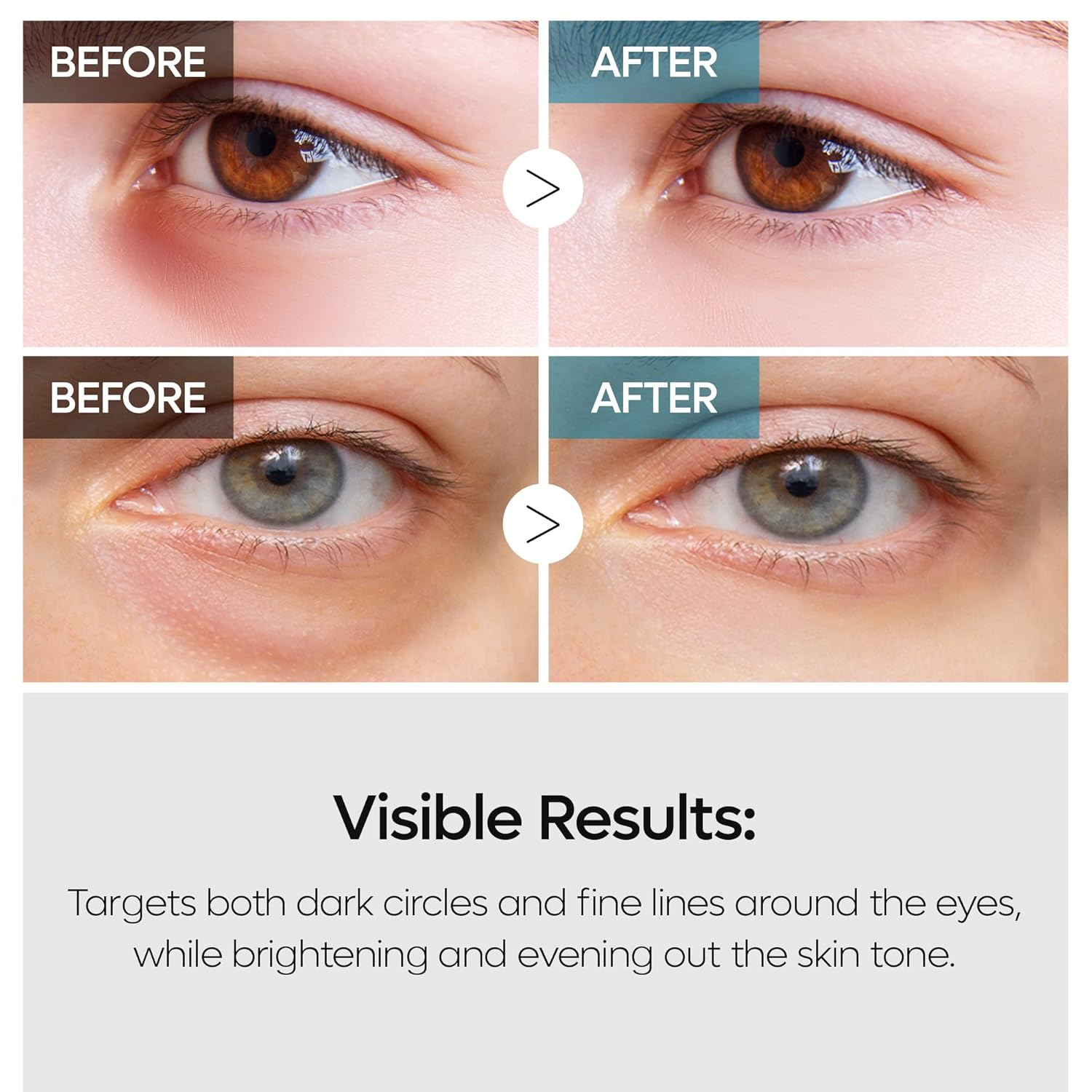 DR MELAXIN Retinalsome Double Effect Eye Cream 3 skincare-kbeauty-glowtime-dr melaxin retinalsome double effect eye cream