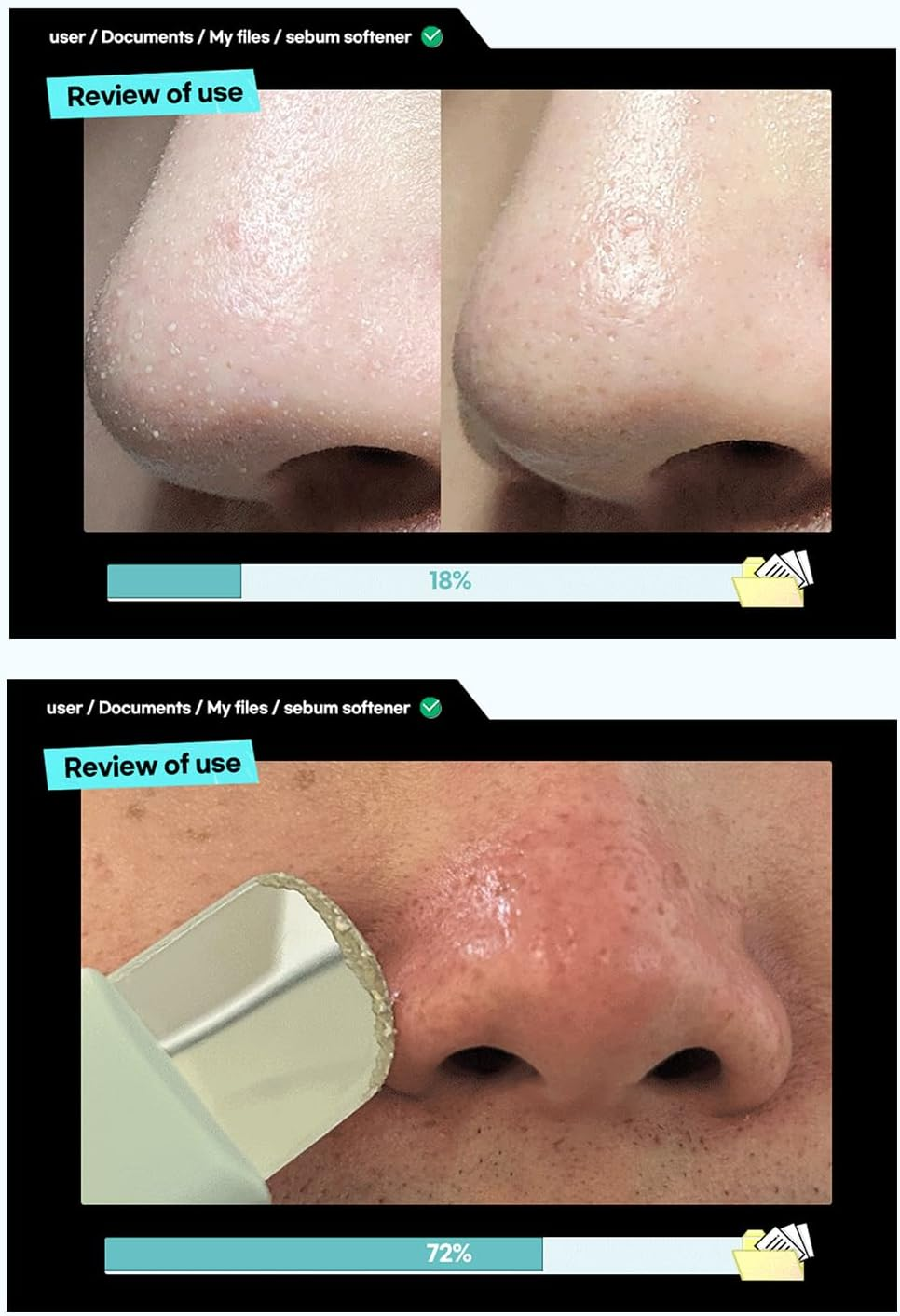 ILSO Melting Sebum Softener 6 skincare-kbeauty-glowtime-melting sebum softener