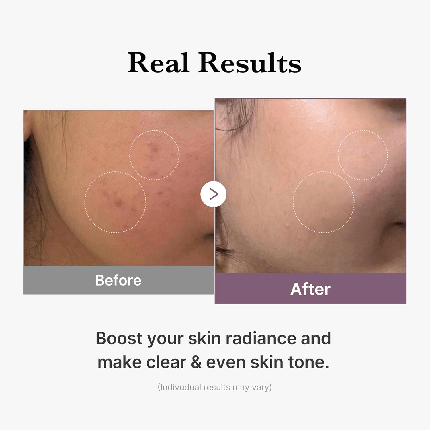 MEDICUBE Age-R Glutathione Glow Toner 5 skincare-kbeauty-glowtime-medicube age r glutathione glow toner