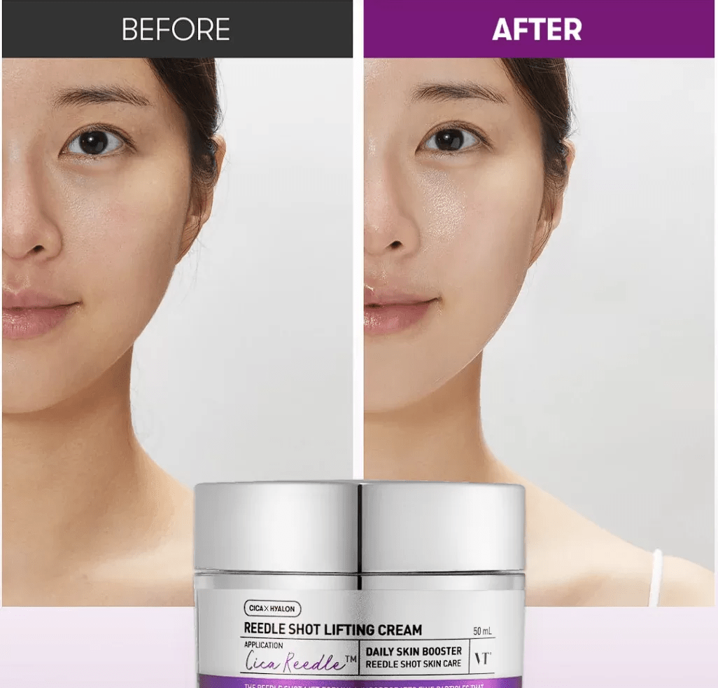 VT COSMETICS Reedle Shot Lifting Cream 5 skincare-kbeauty-glowtime-vt cosmetics reedle shot lifting cream