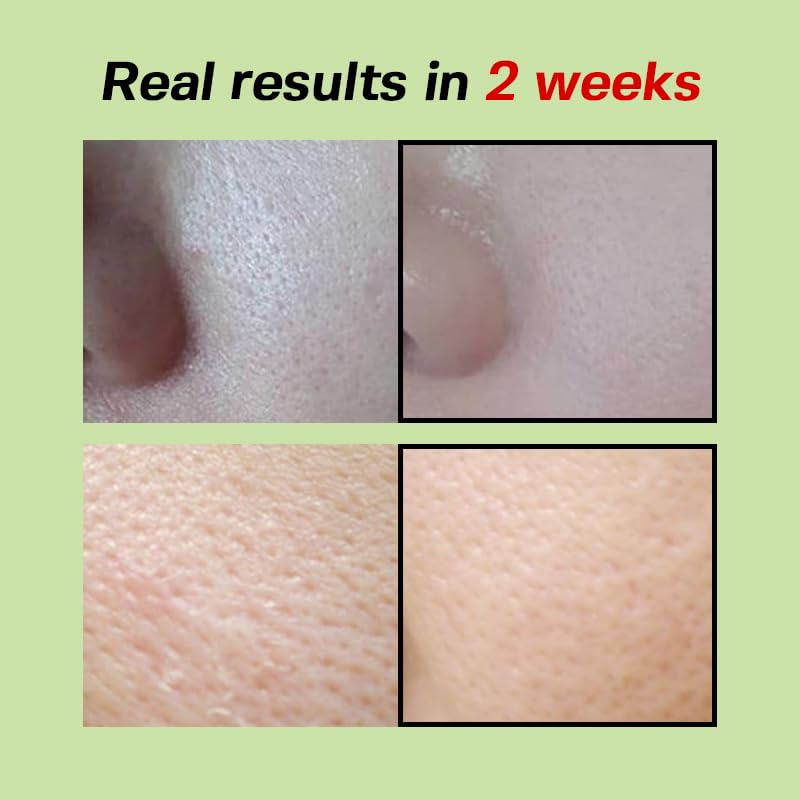 SUNGBOON EDITOR Green Tomato POre LIfting Ampoule 7 skincare-kbeauty-glowtime-sungboon edition green tomato pore lifting ampoule