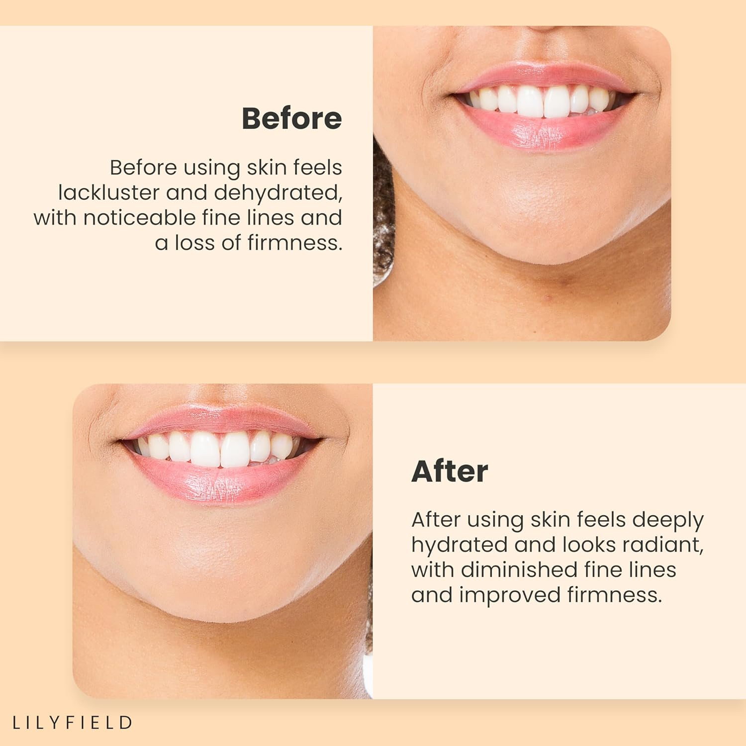 LILYFIELD Wrinkle Correcting Phyto Collagen Serum 3 skincare-kbeauty-glowtime-lilyfield wrinkle correcting phyto collagen seum
