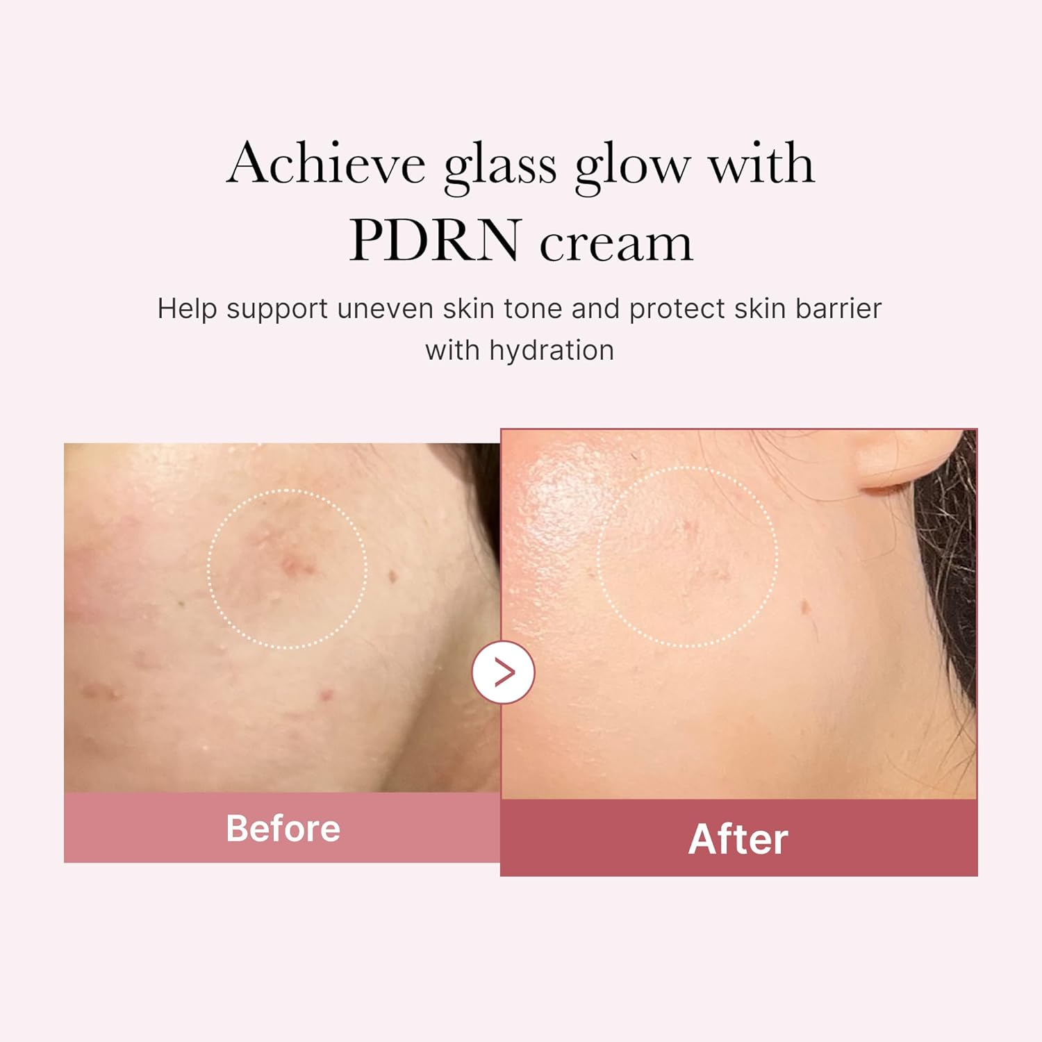 MEDICUBE PDRN Pink Hyaluronic Moisturizing Cream 3 skincare-kbeauty-glowtime-medidube pdrn pink hyaluronic moisturizing cream