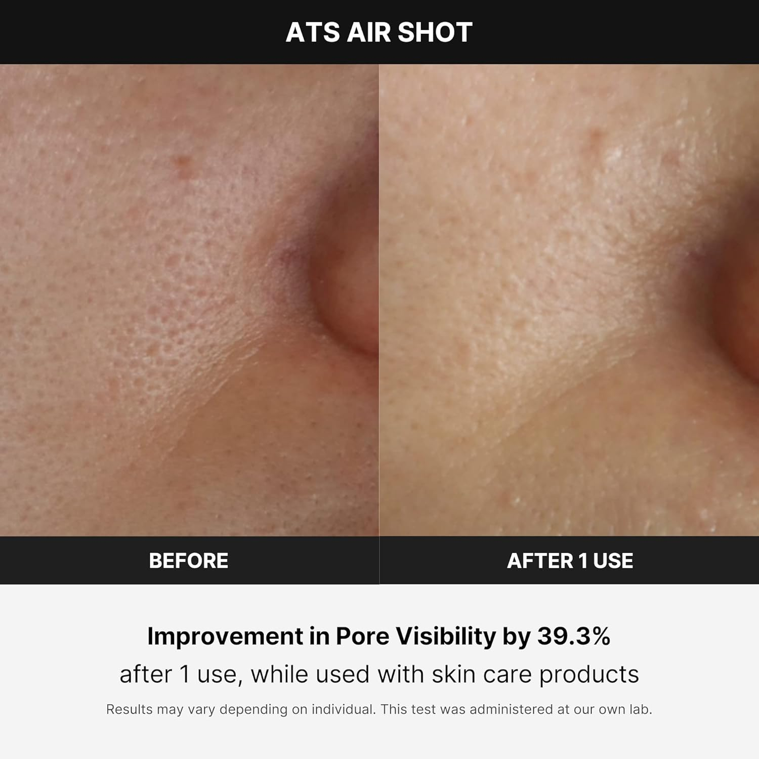 MNEDICUBE Age R Air ATS Air Shot 4 skincare-kbeauty-glowtime-age r air ats air shot