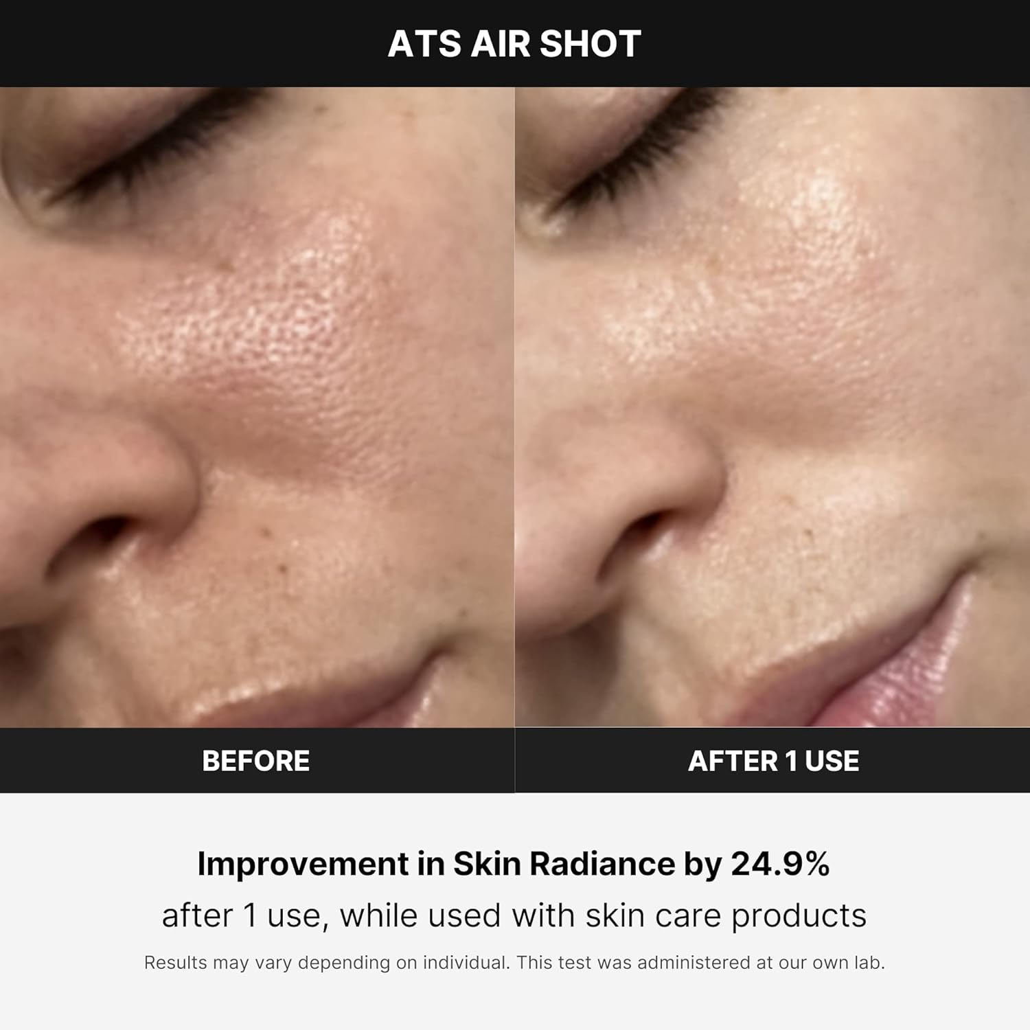 MNEDICUBE Age R Air ATS Air Shot 5 skincare-kbeauty-glowtime-age r air ats air shot