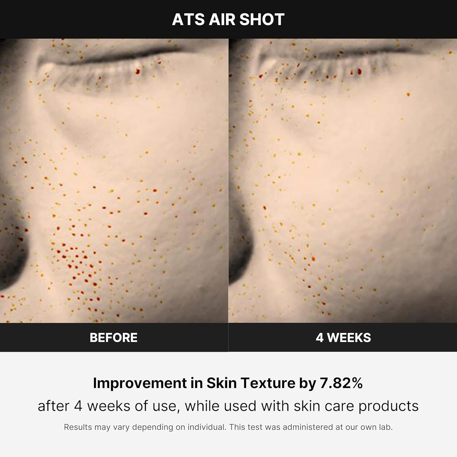 MNEDICUBE Age R Air ATS Air Shot 6 skincare-kbeauty-glowtime-age r air ats air shot
