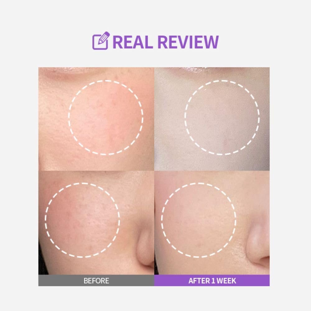 SUNGBOON EDITOR Meoru POdo Vita C Dark Spot Ampoule 4 skincare-kbeauty-glowtime-sungboon editor meoru podo vita c dark spot ampoule