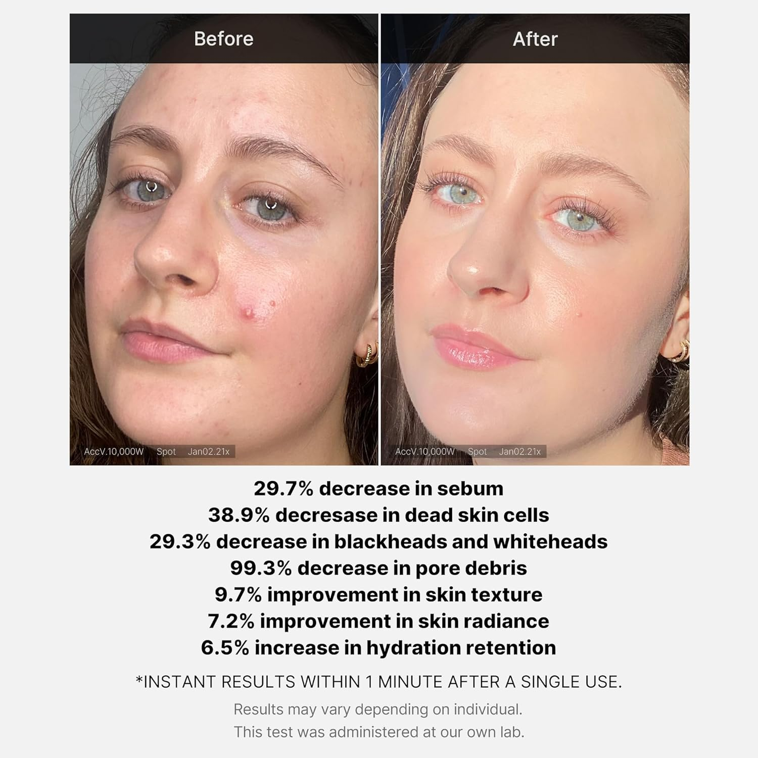 MEDICUBE REd Acne Succinic Acid Peel 6 skincare-kbeauty-glowtime-medicube red acne succinic acid peel