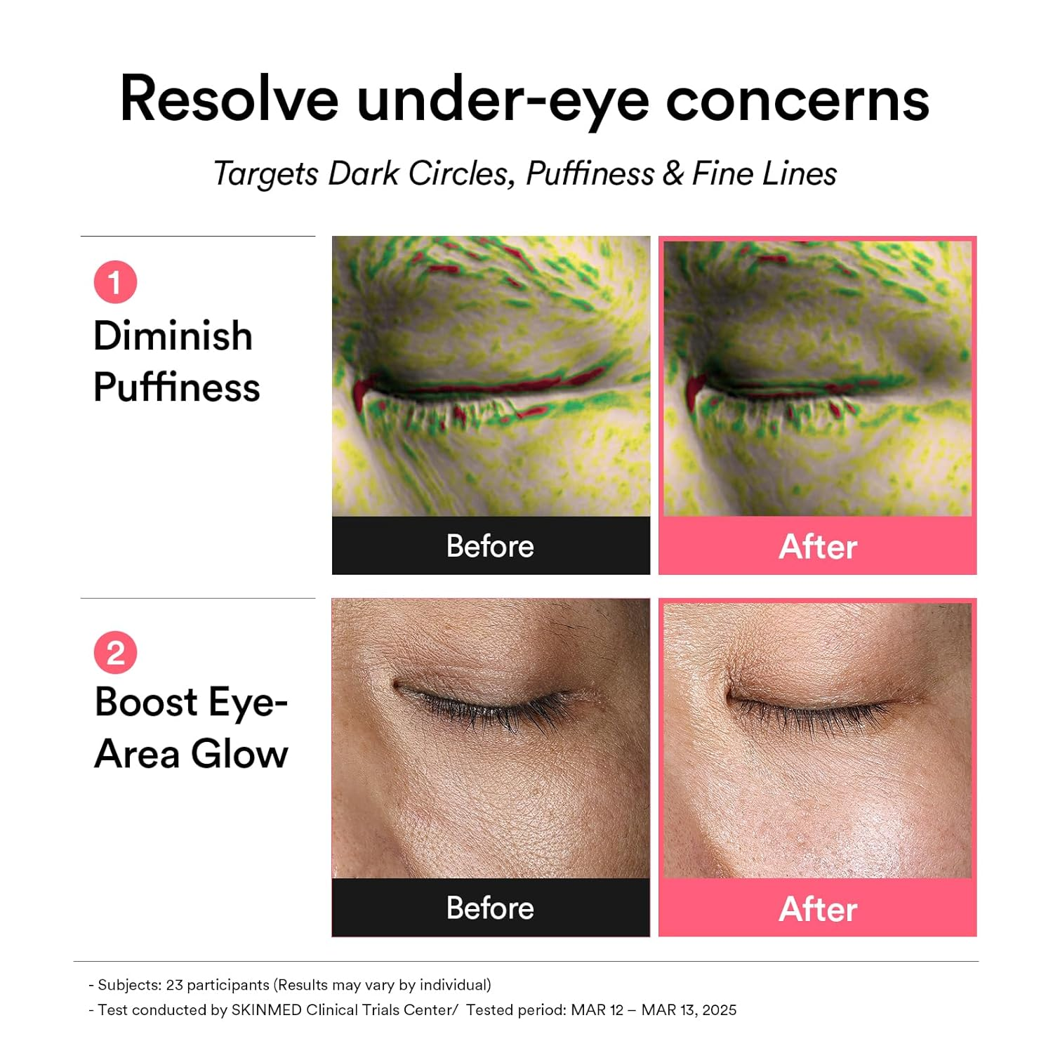 Abib PDRN Retinal Eye patch Jelly 5 skincare-kbeauty-glowtime-abib pdrn retinal eye patch jelly