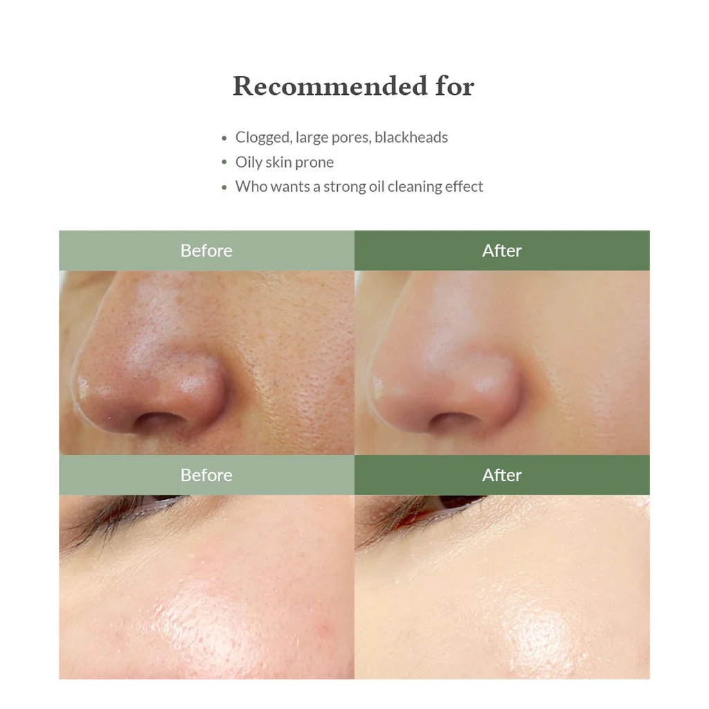 DR ALTHEA Premium Quick Step Sebum Cleanser 7 https://staging.glowtime.mu/shop/some-by-mi-aha-bha-pha30-days-miracle-acne-clearbody-cleanser/
