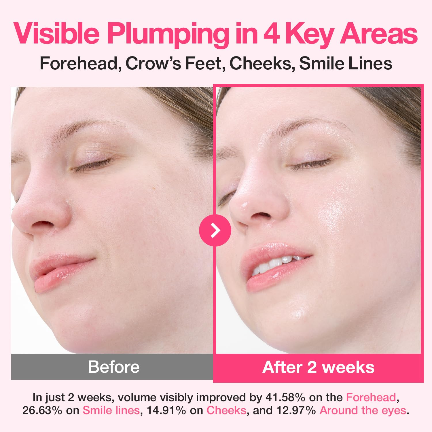 NUMBUZIN 2 Rose PDRN Plumping serum 4 skincare-kbeauty-glowtime-numbuzin 2 rose pdrn 2x pluping serum
