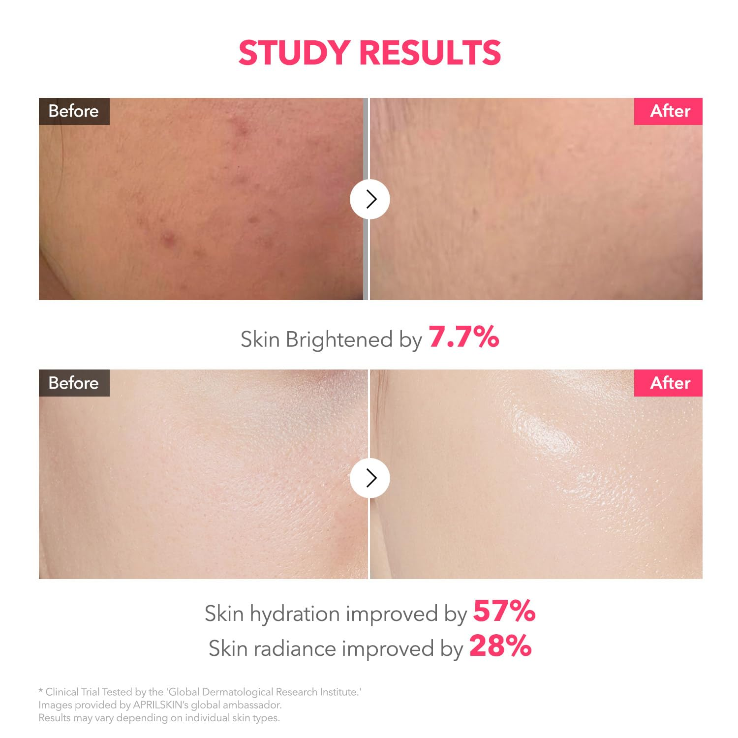TXA Niacinamide Collagen 99 Capsule Gel mask 9