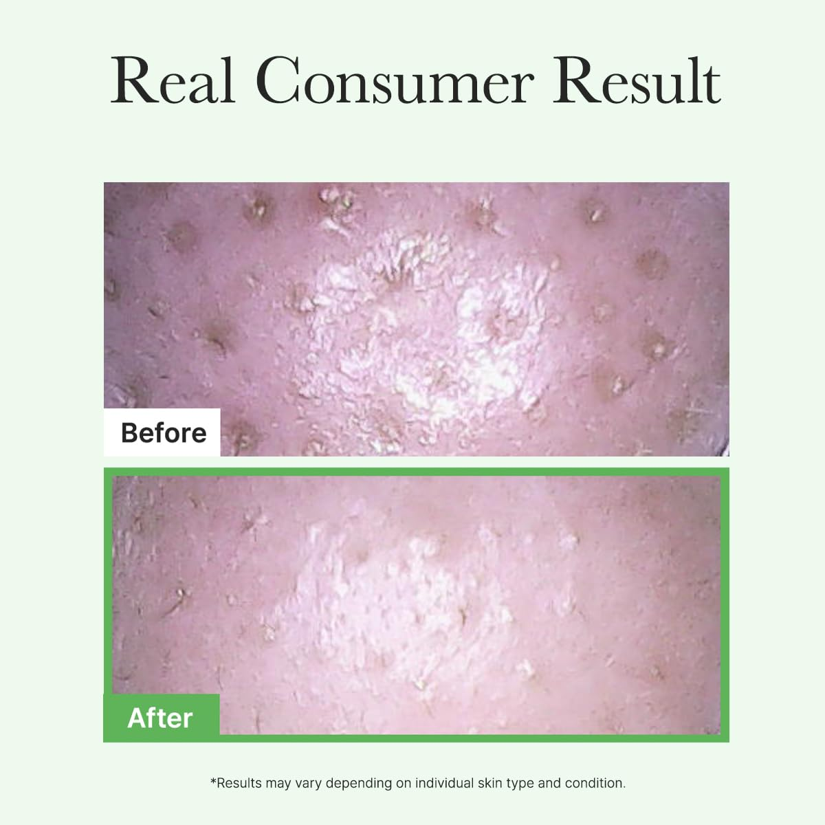 ARENCIA Pore Melt Mochi Cleansing Oil 8 skincare-kbeauty-glowtime-pore melt mochi cleansing oil