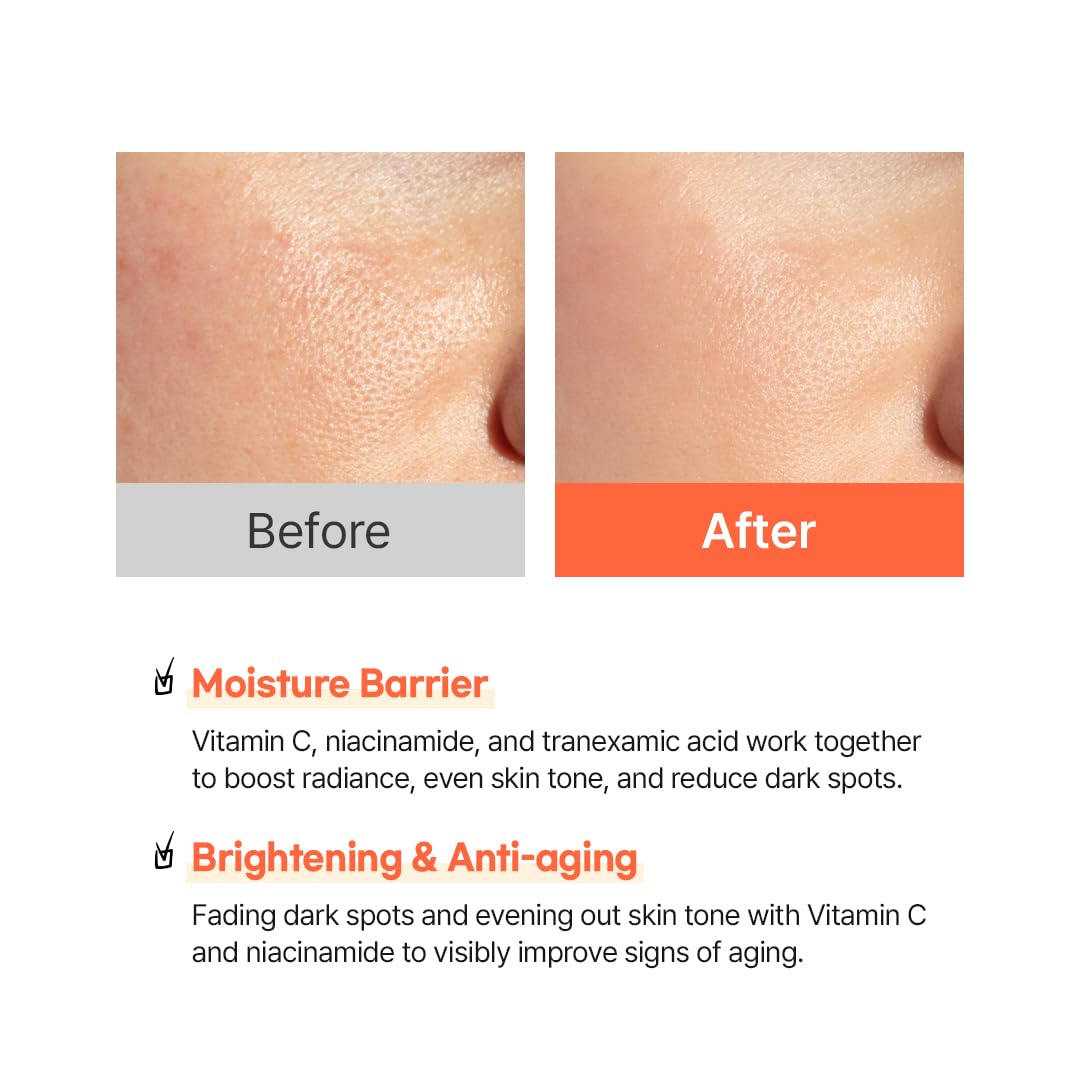 HANSKIN Vitamin C Glow Capsule Lotion 5 skincare-kbeauty-glowtime-hanskin vitamin c glow capsule lotion