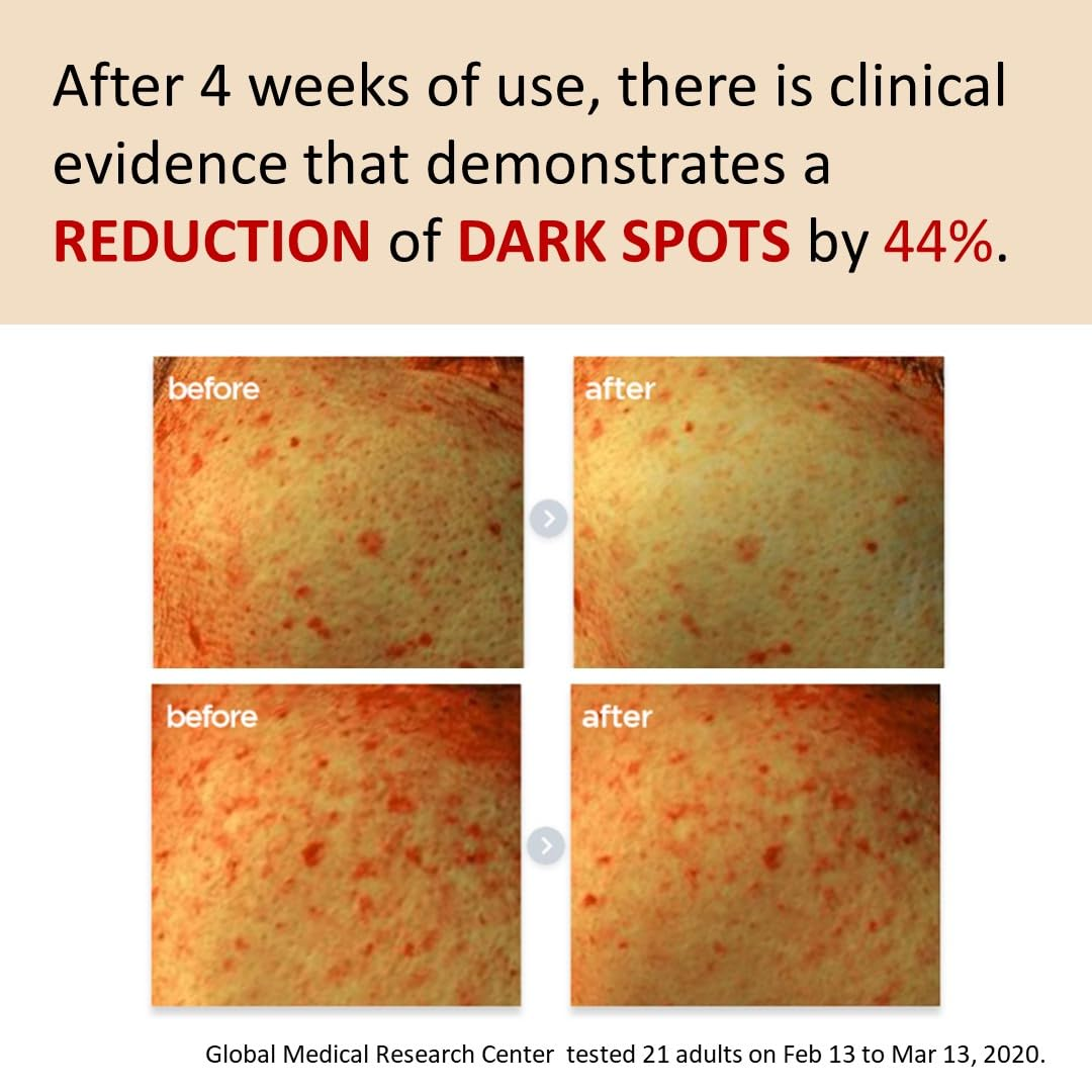 MAKE PREM Poncirus Trifoliata C Dakr Spot Serum 4 skincare-kbeauty-glowtime-make prem poncirus trifoliata c dark spot serum