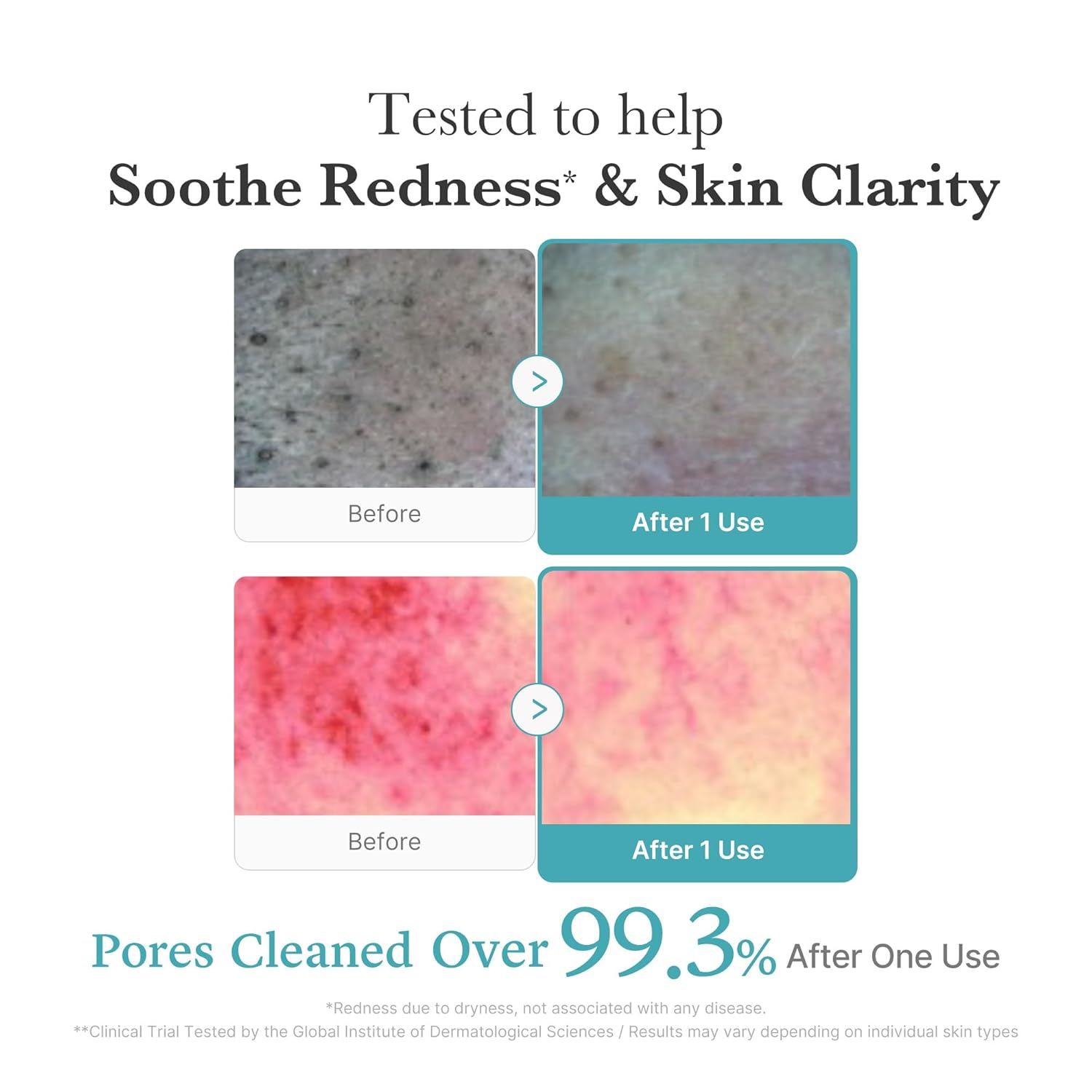 MEDICUBE Azelaic Niacinamide Deep Clean Foam Cleanser 4 skincare-kbeauty-glowtime-medicube azelaic niacinamide deep clean foam cleanser