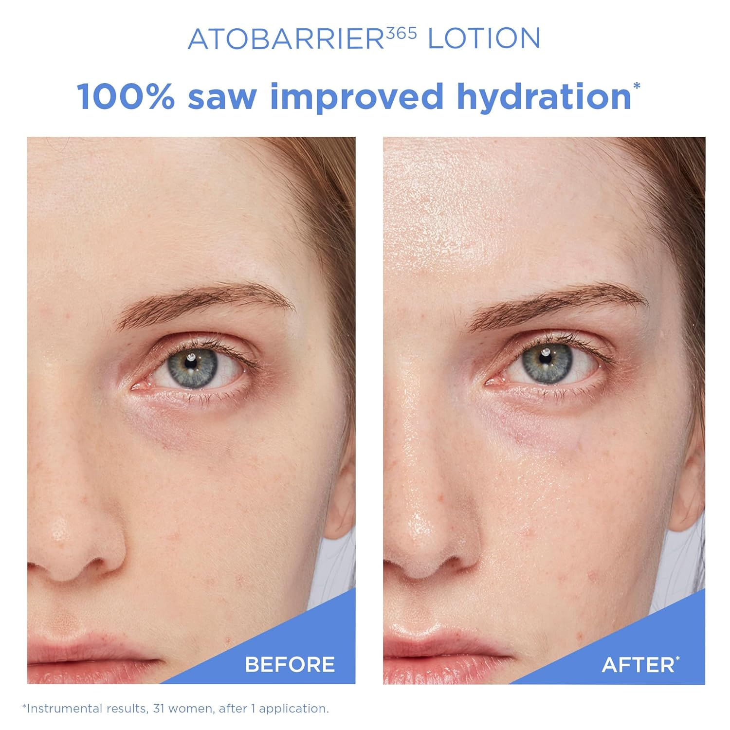 AESTURA Atobarrier 365 Lotion 5 skincare-kbeauty-glowtime-aestura atobarrier 365 lotion