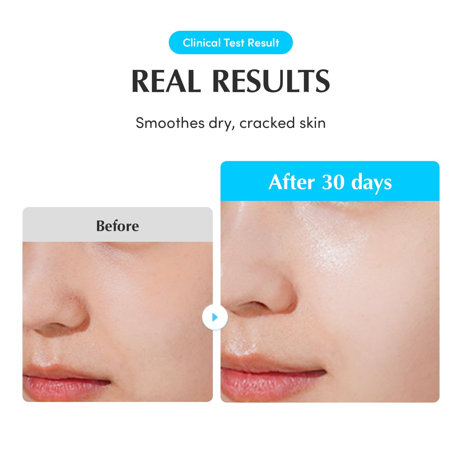 EQQUALBERRY Swimming Pool Ampoule 6 skincare-kbeauty-glowtime-eqqualbeery swimming pool ampoule