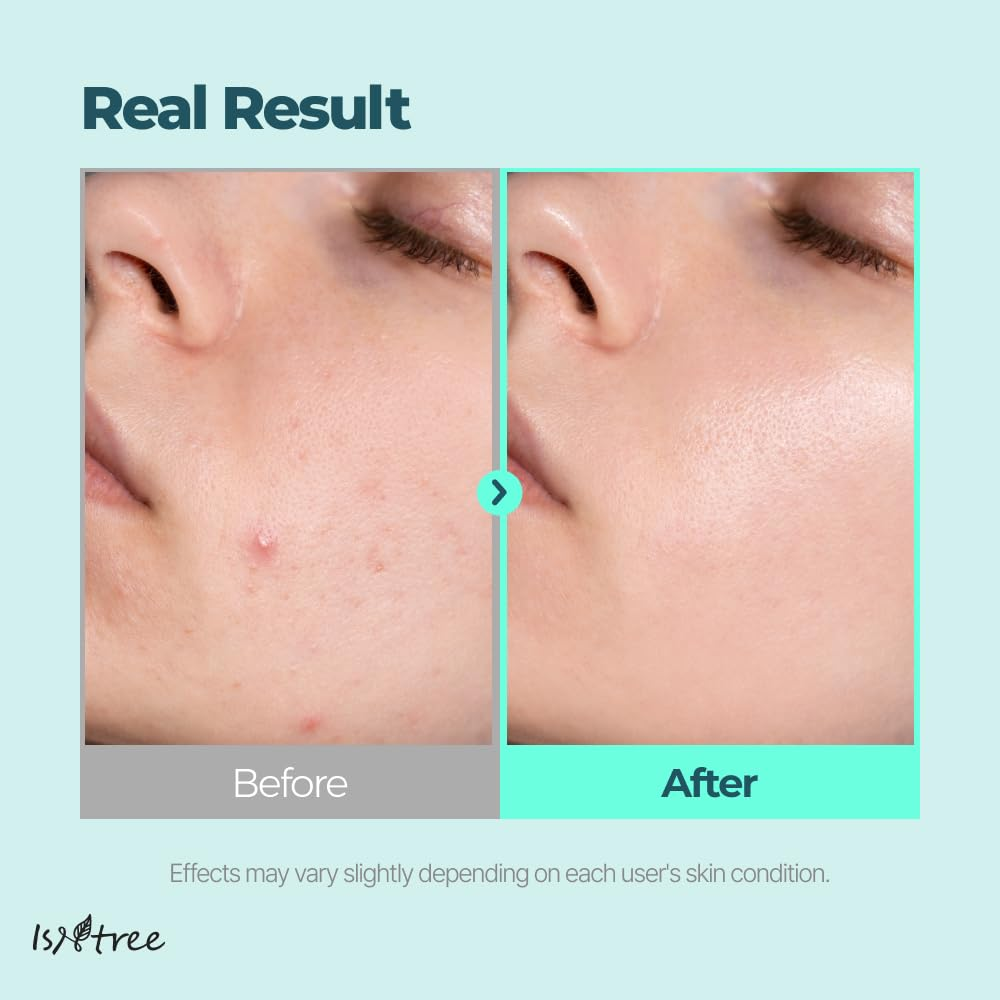 ISTNREE Gim PDRN Deep Sleep Mask 3 skincare-kbeauty-glowtime-isntree gim pdrn deep sleep mask