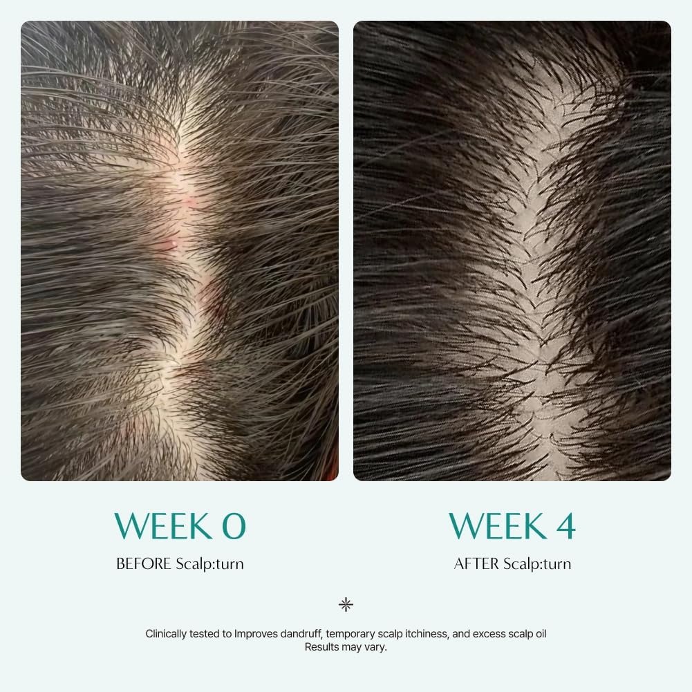LILYEVE Scalp Turn Ccia pdrn brush ampoule 3 skincare-kbeauty-glowtime-lilyeve scalp turn cica pdrn brush ampoule