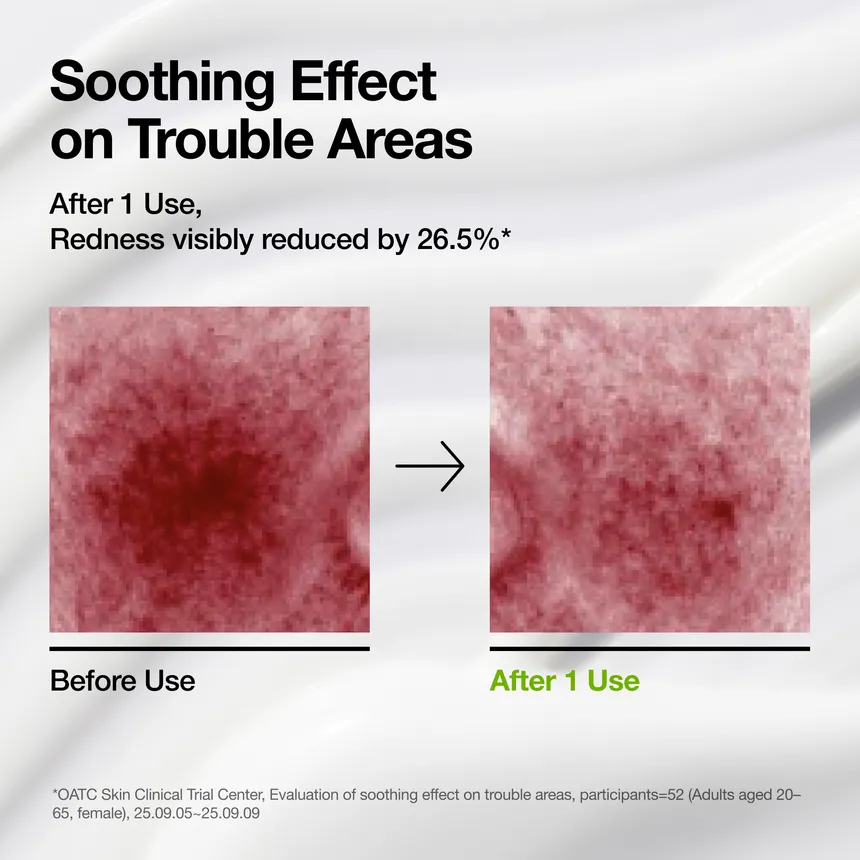 ANUA Azelaic Acid and Cica skin soothing moisturizer 4 skincare-kbeauty-glowtime-anua azelaic acid and cica skin soothing moisturizer