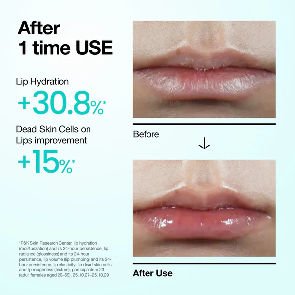 ANUA PDRN lip serum 6 skincare-kbeauty-glowtime-anua pdrn lip serum