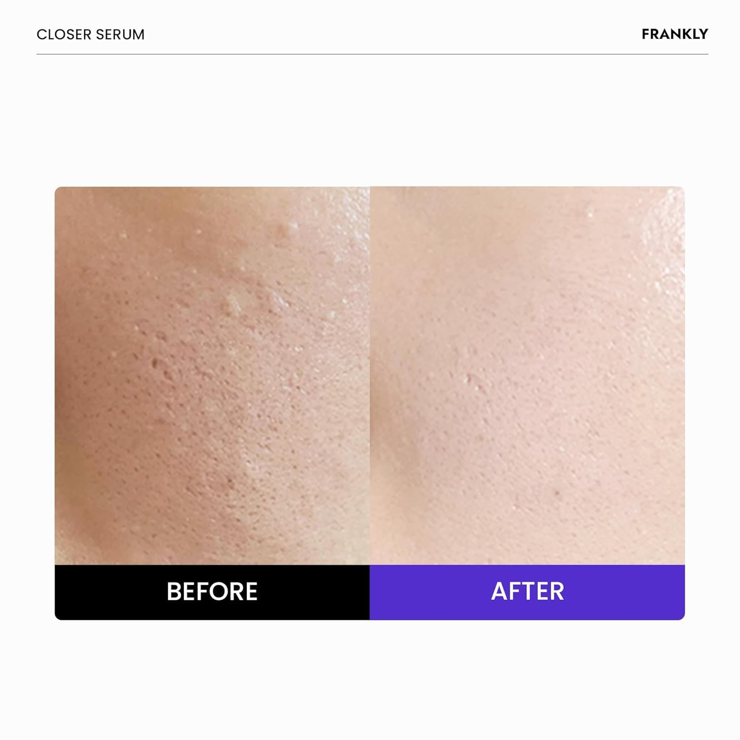 FRANKLY Closer Pore Reducing Serum 2 skincare-kbeauty-glowtime-frankly closer pore reducing serum