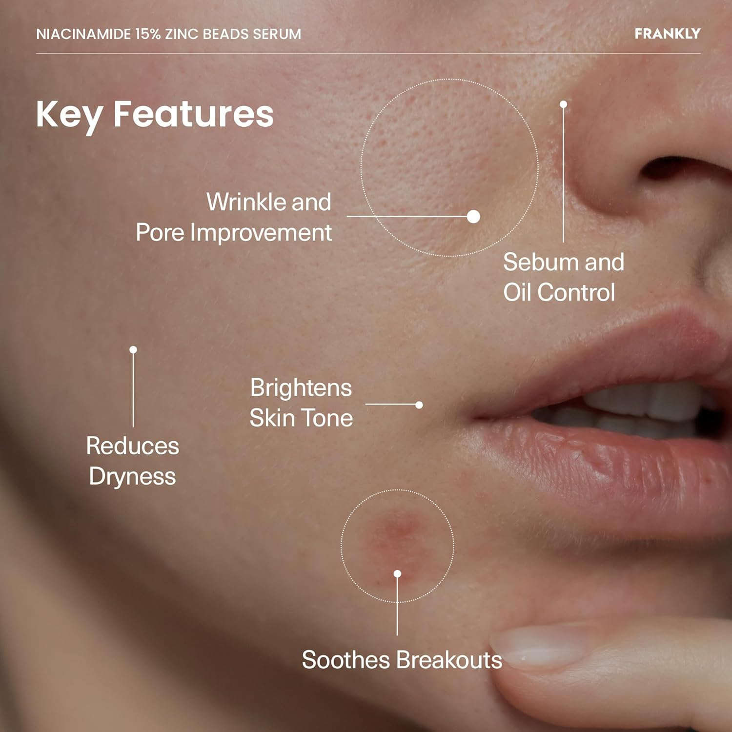 FRANKLY Niacinamide and Zinc Beads Serum 4 skincare-kbeauty-glowtime-frankly niacinamide and zinc beads serum