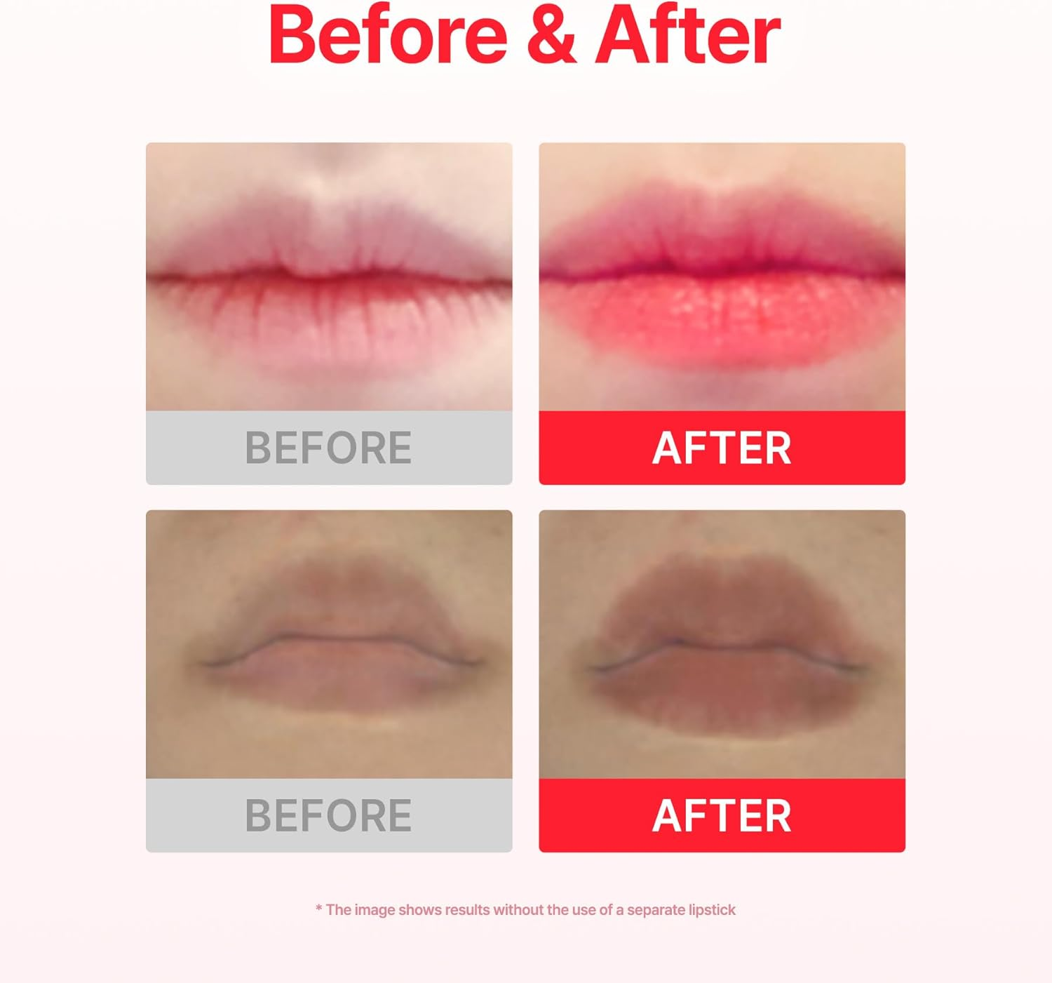 ACROPASS Jolly Filly Lip Plumping patch 4 skincare-kbeauty-glowtime-acropass jolly filly lip plumping patch